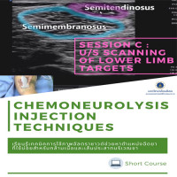 Chemoneurolysis Injection Techniques with US/ES Guidance - Session C : Ultrasound scanning of common targets in lower extremity