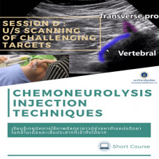 Chemoneurolysis Injection Techniques with US/ES Guidance - Session D : Ultrasound scanning of challenging targets